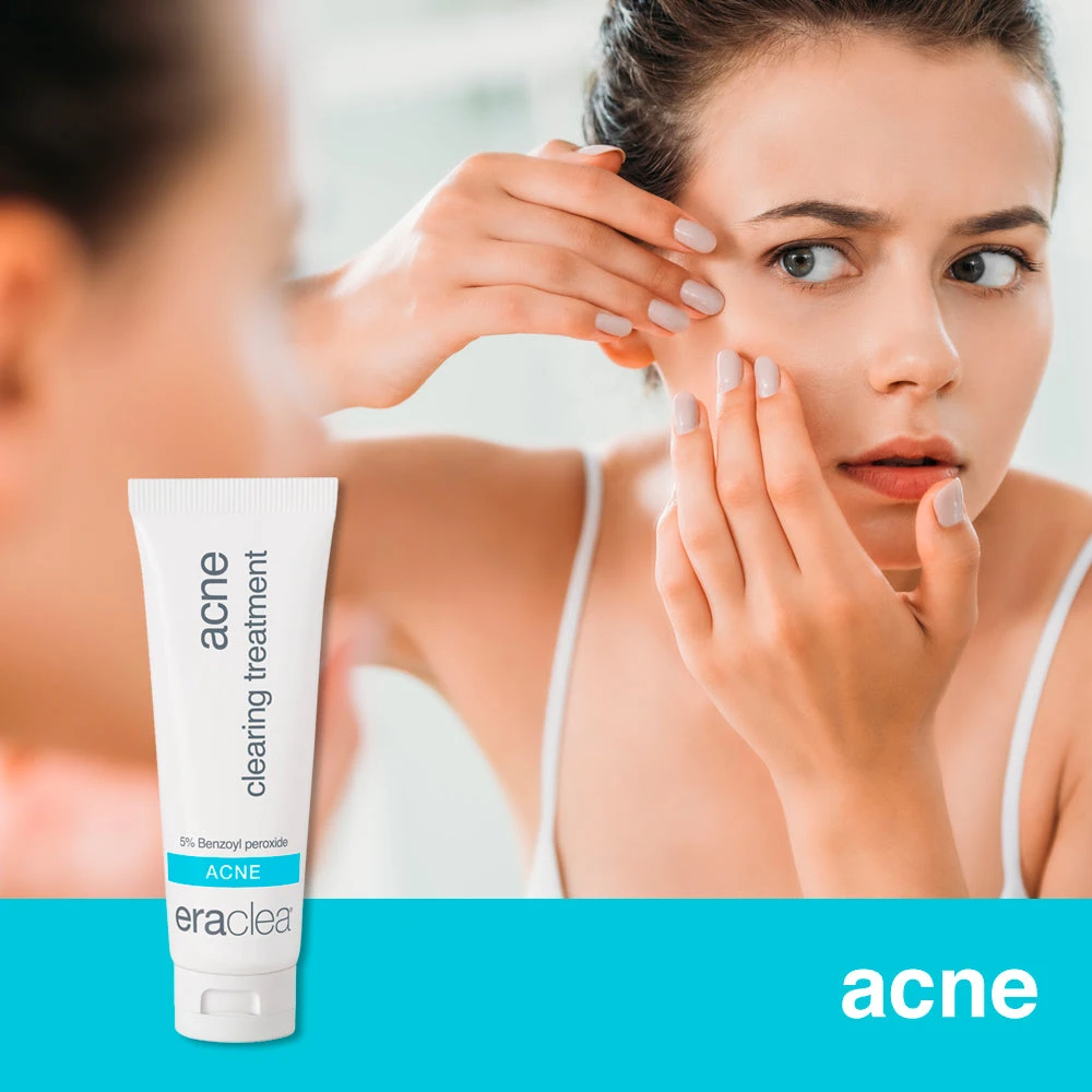 Eraclea Acne Clearing Treatment - Image 4