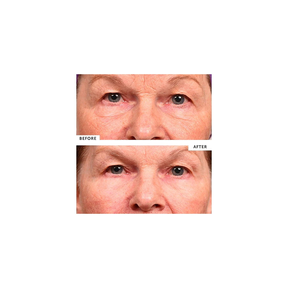 SilcSkin Eye Pads - Image 3